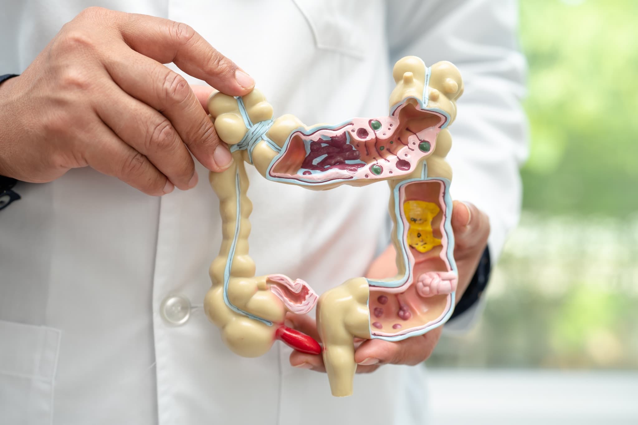 The gut is the upstream of almost everything