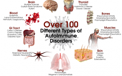 Functional Medicine Approach to Autoimmune Disease